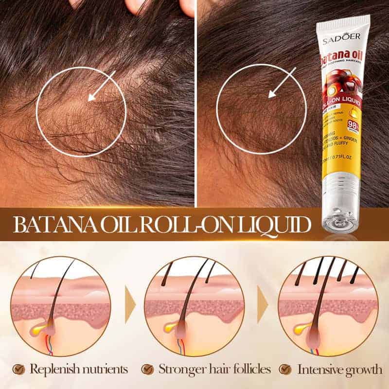 Batana Dense Hair Roll-on Liquid (20ml)