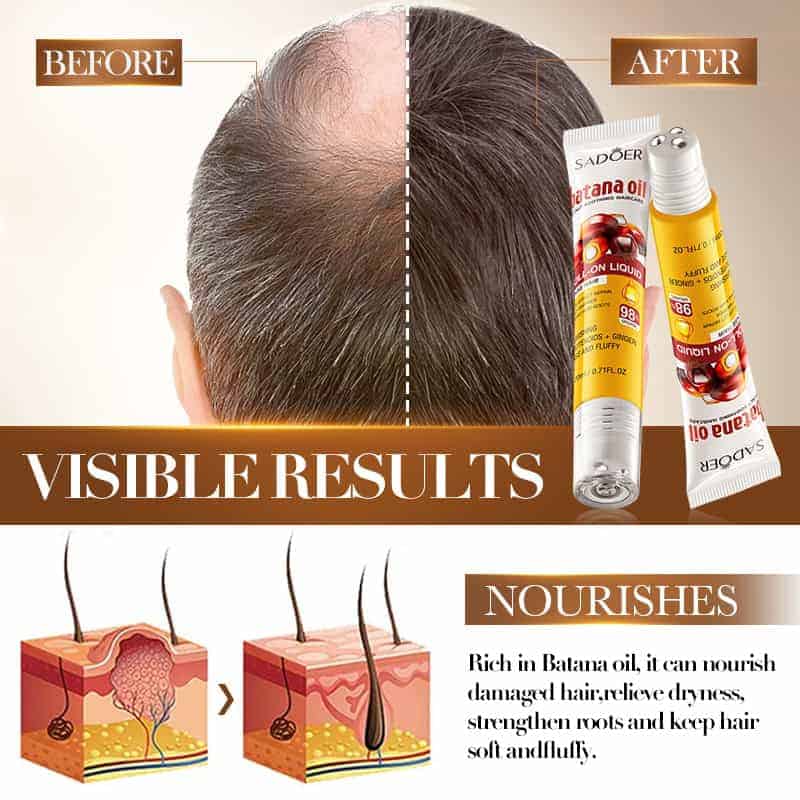 Batana Dense Hair Roll-on Liquid (20ml)