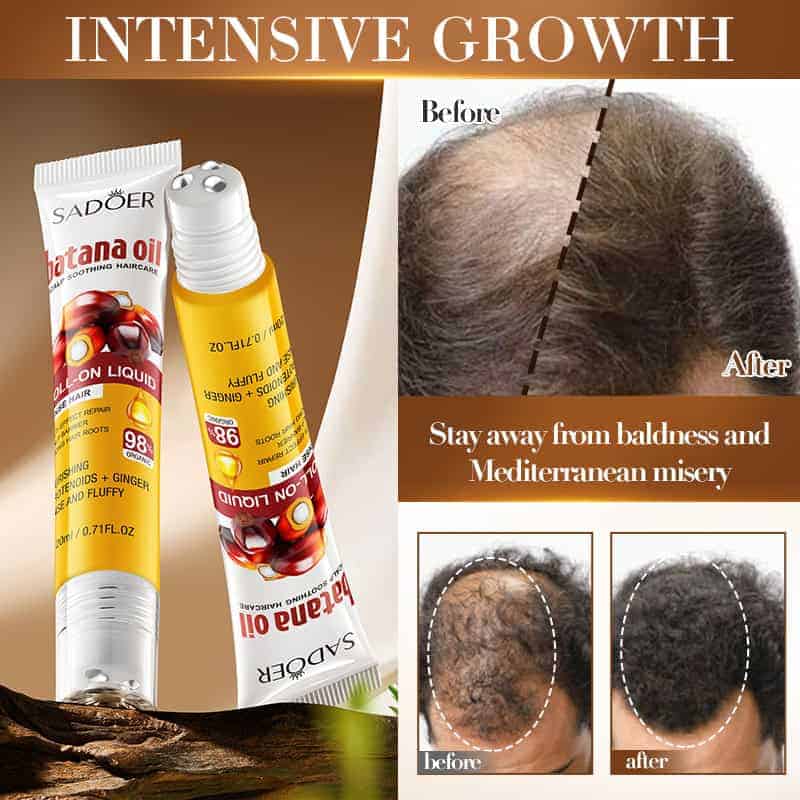 Batana Dense Hair Roll-on Liquid (20ml)
