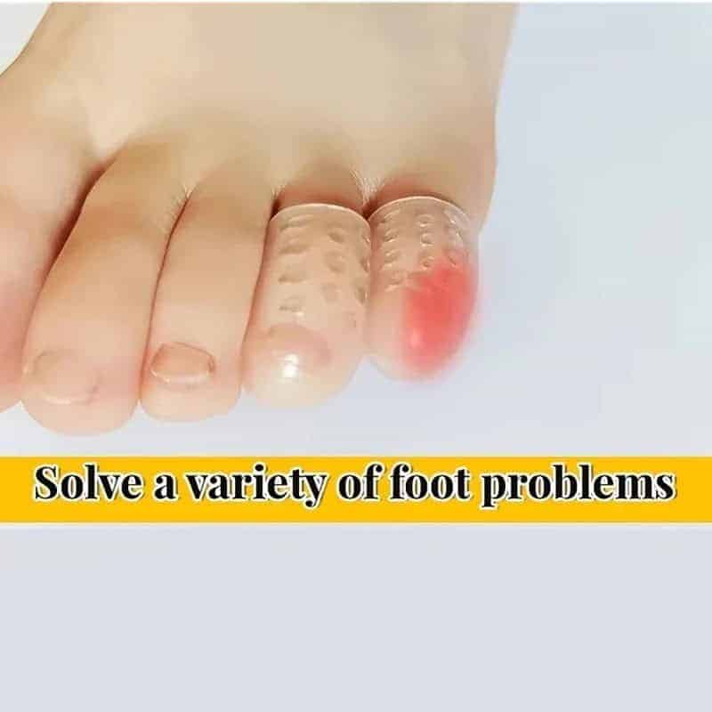 Silicone Toe Protector Caps (2×1cm)